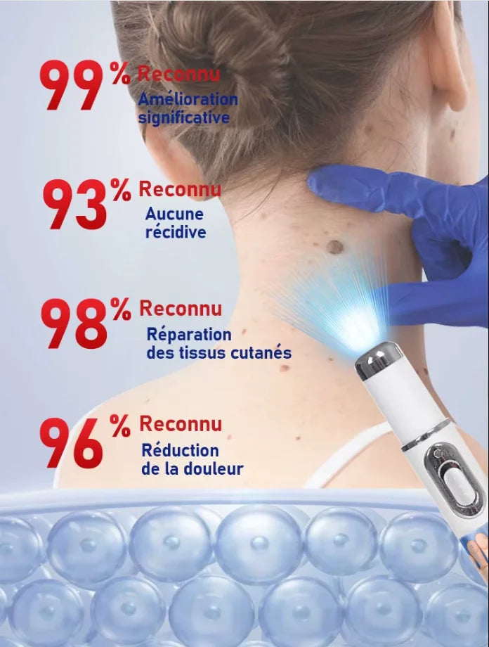 Mini Lᴀsᴇʀ ᵂᵃʳᵗ ᴿᵉᵐᵒᵛᵉʳ Pᴇɴ - Painless & Efficient Removal, Essential for ᴰᵃⁱˡʸ Skin Care