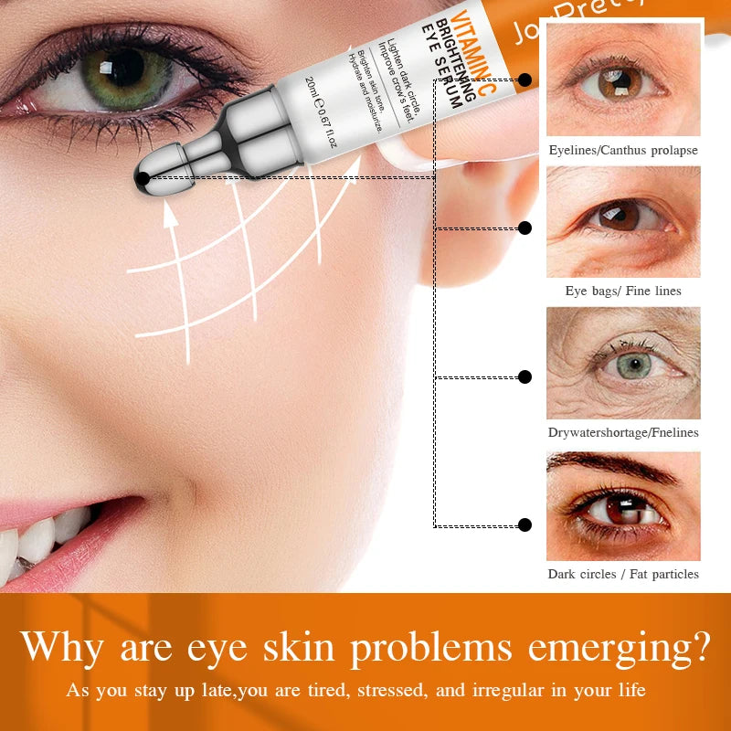 Anti Dark Circle Eye Cream Vitamin C Eye Bags Removal Whitening Lightening Cream Wrinkle Removal Serum Eyes Firming Skin Care