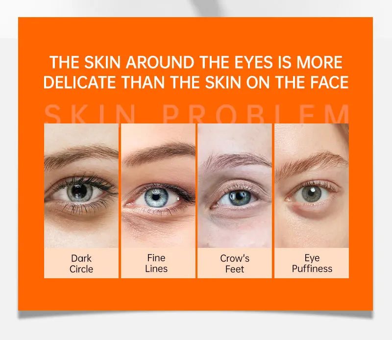 Anti Dark Circle Eye Cream Vitamin C Eye Bags Removal Whitening Lightening Cream Wrinkle Removal Serum Eyes Firming Skin Care